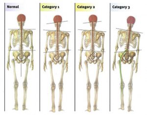 bilan postural, posturologie, ostéopathie, le luc, gary monfort
